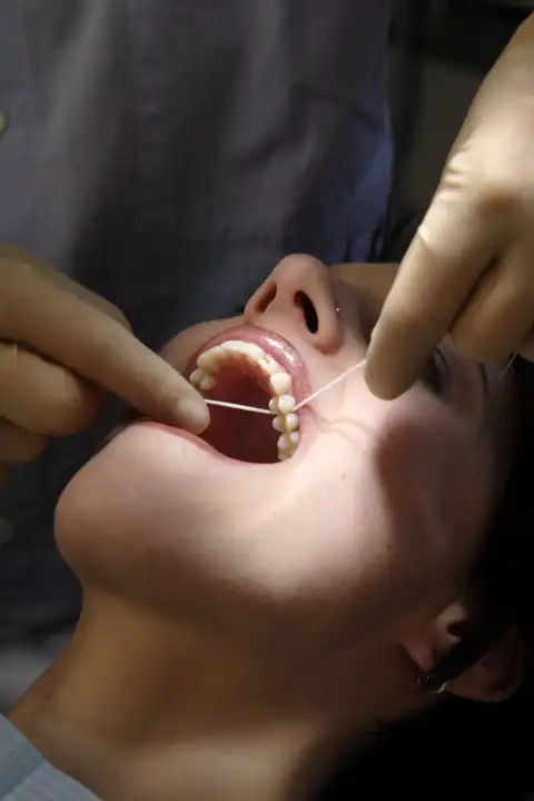 Cleaning teeth with dental floss