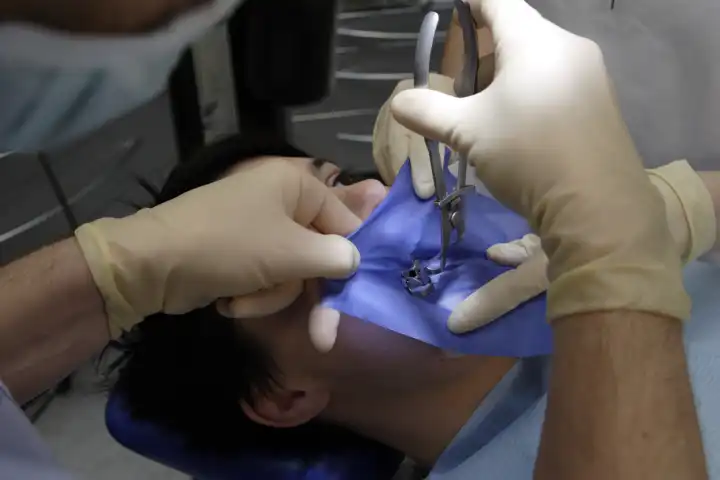 Behandlung mit Kofferdamm beim Zahnarzt