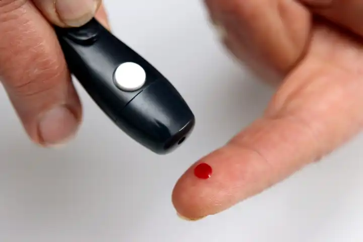 The measurement of blood glucose