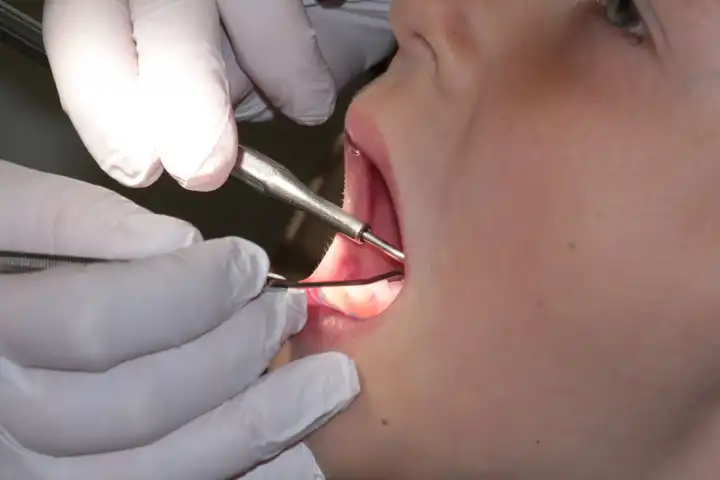 Zahnbehandlung