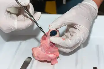 Dissecting a cow's eye - examining the eyeball with scissors, close-up