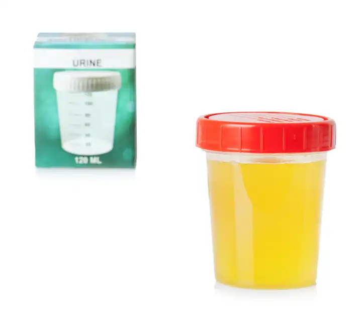 Urine sample in container isolated on white background