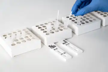 Covid 19 rapid test cassettes during evaluation in a free test center, examination after sample collection with a cotton swab